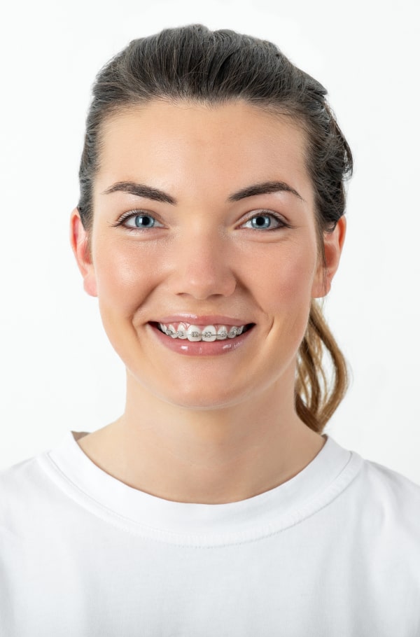 Managing Soreness from Braces & Appliances – What You Need to Know. A boy in a yellow hat is joyfully smiling on the street