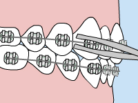 Infographics Loose Wire Adjustments 